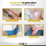 Vier afbeeldingen van bescherming: tatoeages, verband, gips en gevoelige huid.